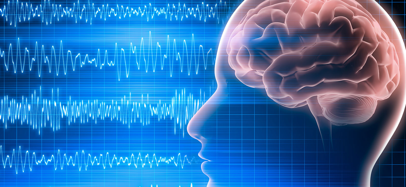Neurofeedback/Biofeedback Fries